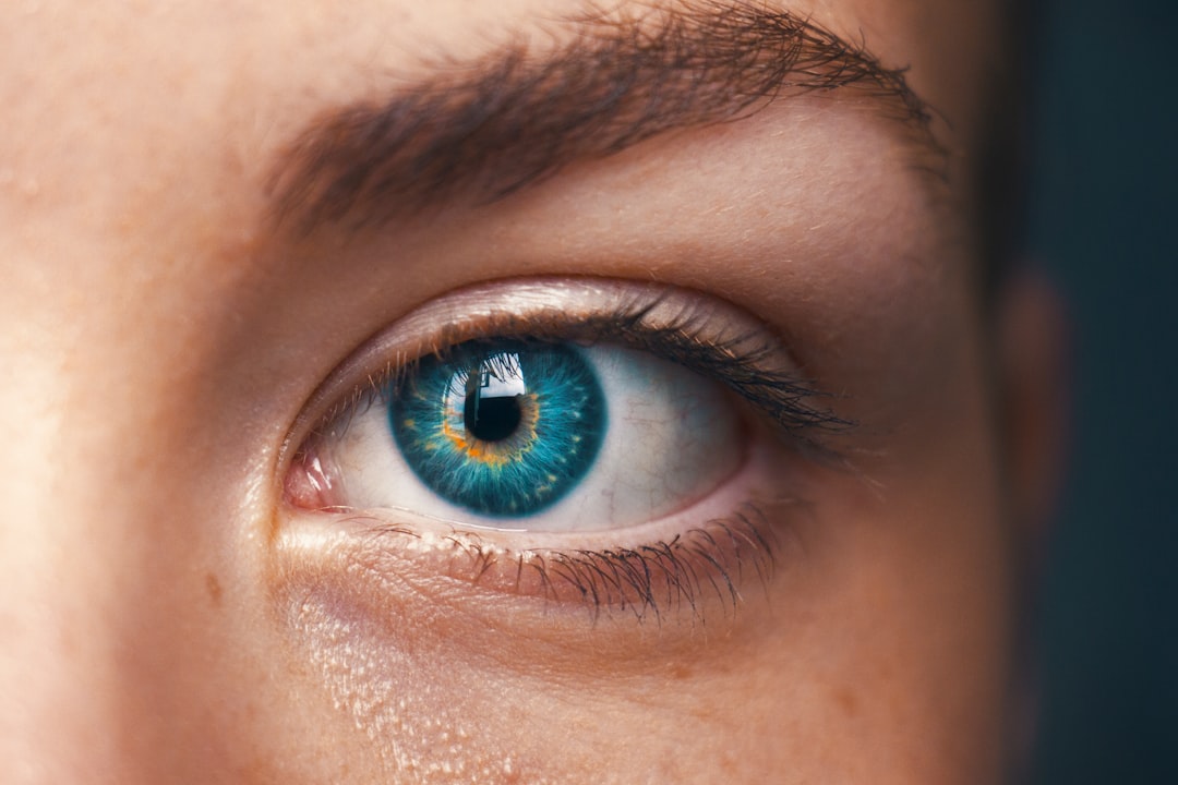 How Much Does Pinguecula Removal Cost in the UK?